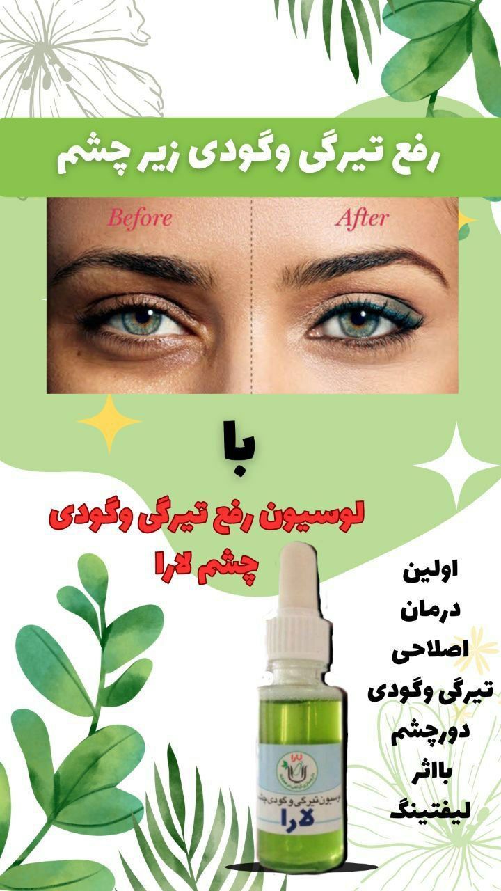 لوسیون رفع تیرگی و گودی زیر چشم کیفیت عالی جوابدهی بی نظیر