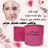 کرم بوتاکس و گونه گذار دناطب صددرصد اصلی (چاقی صورت فقط در سه هفته)